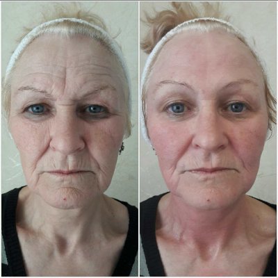 массаж лица "гуаша"