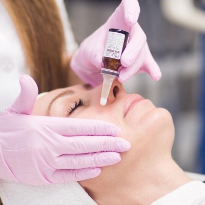 PQ AGE от Promoitalia (пилинг-биоревитализация) на область лица и шеи 