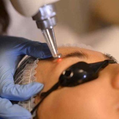 Хвостики бровей 