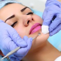 Чистка лица механическая 