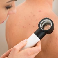 Чистка спины механическая