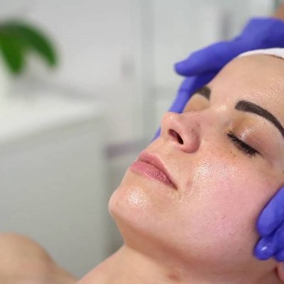 Пилинг carboxy  СO2 therapy для век