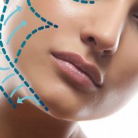 RF лифтинг лица и подбородка 