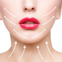 RF лифтинг нижней (верхней) трети лица (15 минут)  