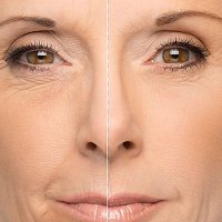 Гусиные лапки