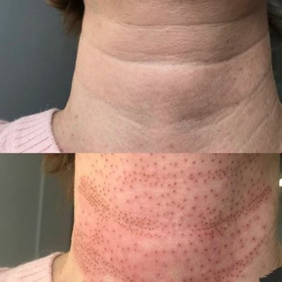 Кольца венеры 