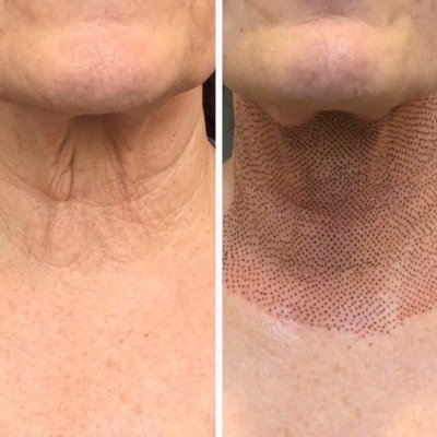 Шея полностью