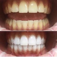  КАДАЛИЕВА ЛЯЛЯ