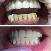  КАДАЛИЕВА ЛЯЛЯ