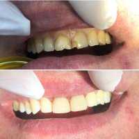  КАДАЛИЕВА ЛЯЛЯ