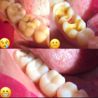  КАДАЛИЕВА ЛЯЛЯ