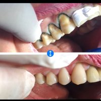  КАДАЛИЕВА ЛЯЛЯ