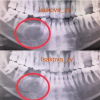 ИСАКОВА ЗАРИНА