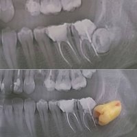 ИСАКОВА ЗАРИНА