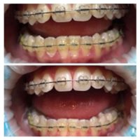 ЧОНИАШВИЛИ МАРИНА