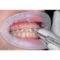 ЧОНИАШВИЛИ МАРИНА