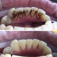 ЧОНИАШВИЛИ МАРИНА