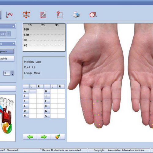Су джок тест ( психосоматика )