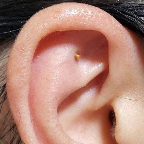 Аурикуло гарпун ( золотая игла ) анти стресс