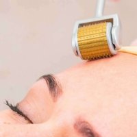 Косметология микронидлинг (мезороллер)