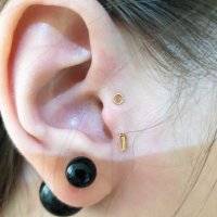 Аурикуло серьга ( золотая игла ) снижение аппетита