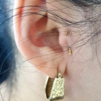 Аурикуло серьга ( золотая игла ) снижение аппетита