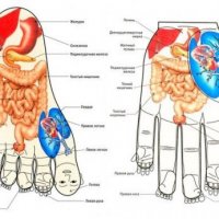 Рефлексотерапия ( су-джок ) 
