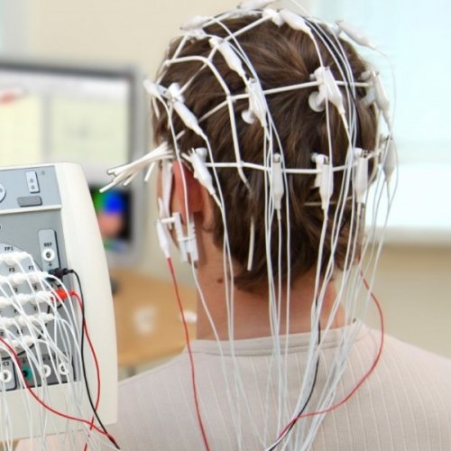 Электроэнцефалограмма ( ЭЭГ )