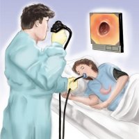 ФГДС (гастроскопия) под седацией