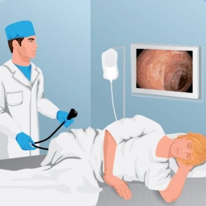 ФКС (колоноскопия) без седации