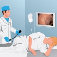 ФКС (колоноскопия) без седации