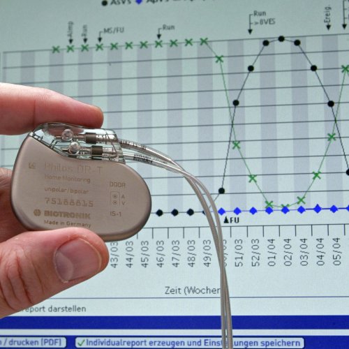 Программирование кардиостимулятора