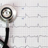 Электрокардиограмма