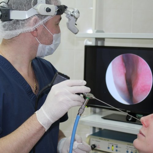 Шейверная конхотомия (редукция носовых раковин)