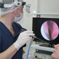 Шейверная конхотомия (редукция носовых раковин)