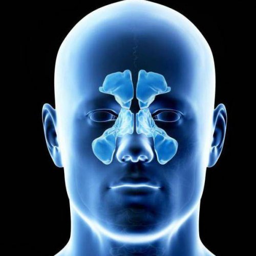 Рентген пазух носа