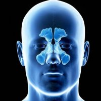 Рентген пазух носа