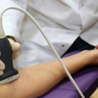 УЗИ сосудов верхних конечностей