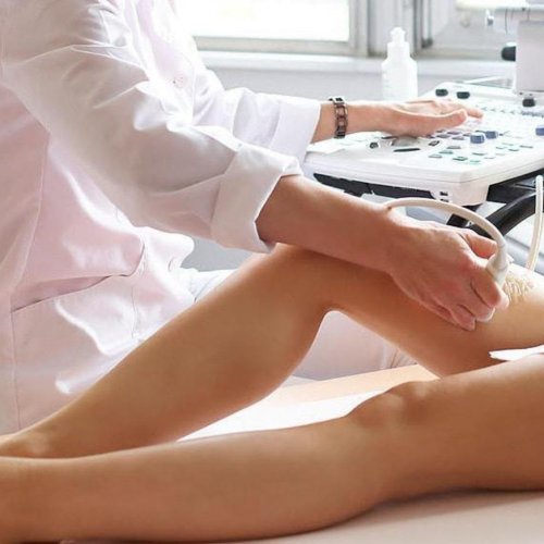 УЗИ сосудов нижних конечностей