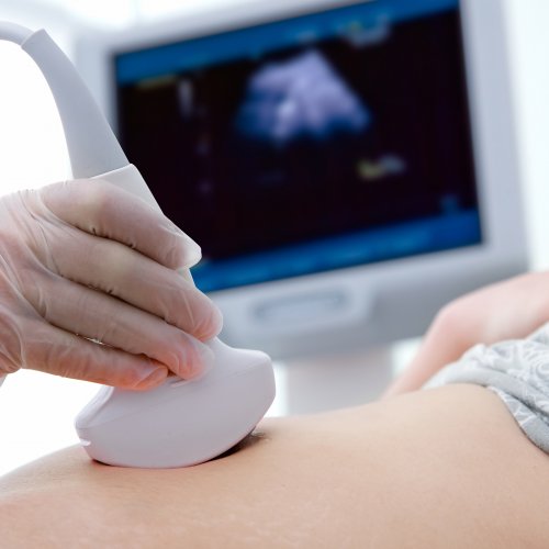 УЗИ 18-28 неделя беременности