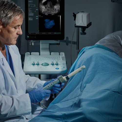 УЗИ предстательной железы и мочевого пузыря