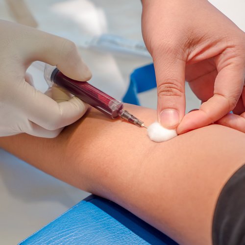 Забор крови из вены