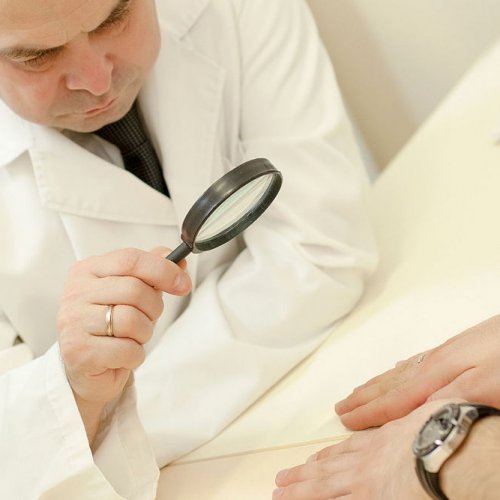 Повторный  прием врача дерматолога