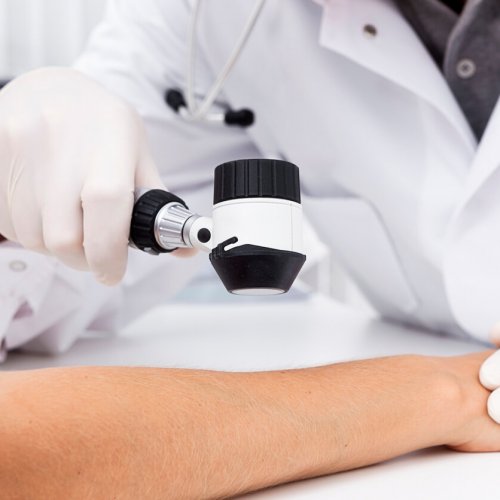 Повторный прием врача дерматовенеролога