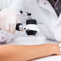 Первичный прием врача дерматовенеролога