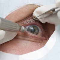 Ретробульбарная инъекция 1 глаз