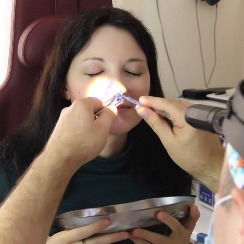 Рассечение синехий под местной анестезией