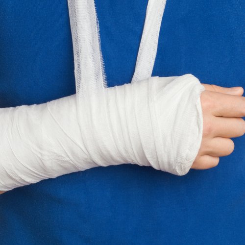 Наложение малой гипсовой повязки