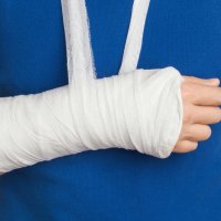 Наложение малой гипсовой повязки