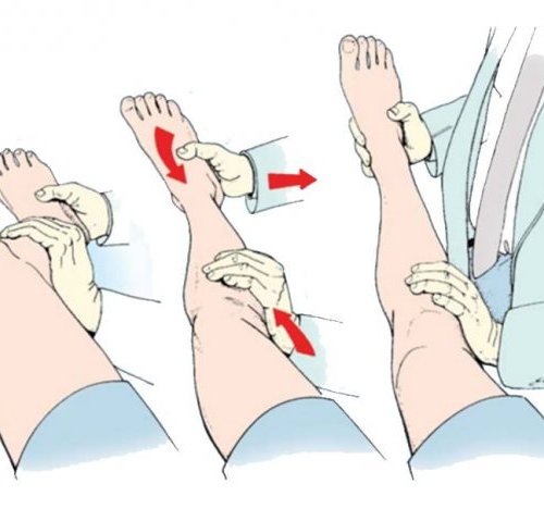 Вправление вывиха, закрытая ручная репозиция (без стоимости медикаментов)